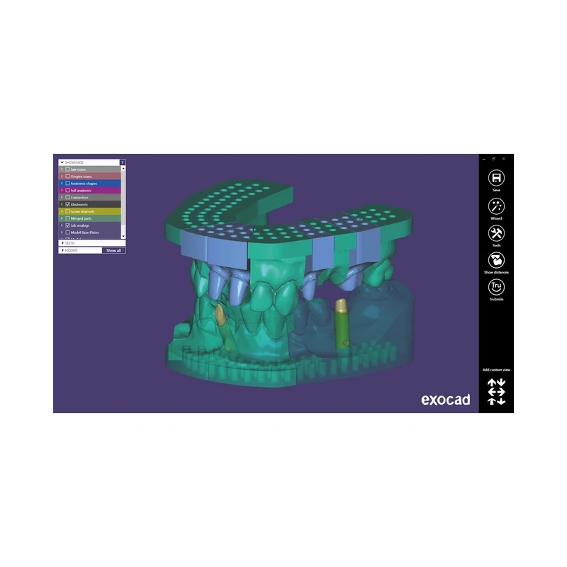 Exocad Model Creator - модуль для создания моделей | Exocad (Германия)
