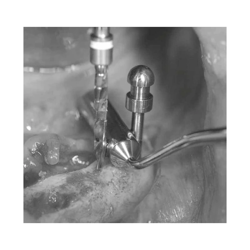 LM Implant Misura MR 3.1-5.3 - инструмент для позиционирования имплантатов | LM-Instruments Oy (Финляндия)