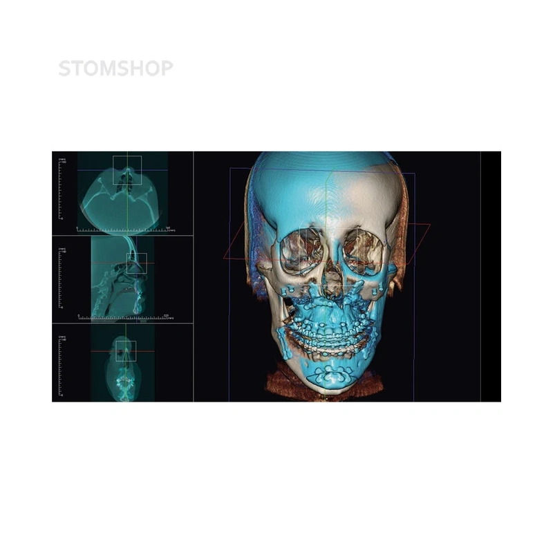 OP 3D Vision - аппарат панорамный рентгеновский стоматологический с функцией томографии | KaVo (Германия)