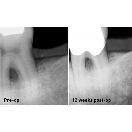 FONALaser - стоматологический диодный лазер | FONA Dental s.r.o. (Италия)