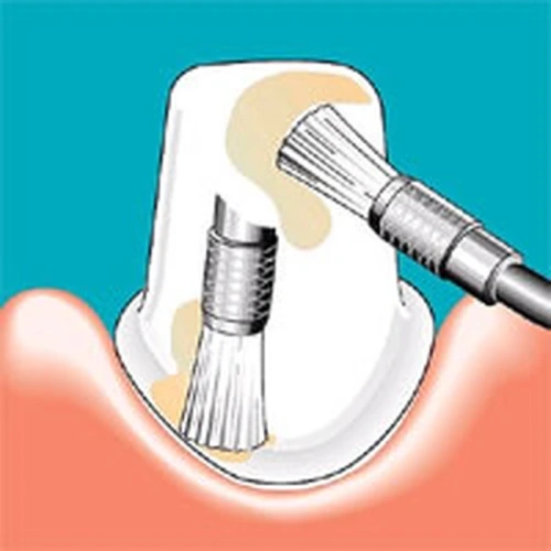 Sonicflex clean №48 A - насадка для щеток Sonicflex clean | KaVo (Германия)