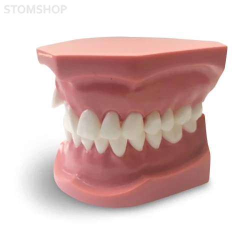 ORB05 – ортодонтическая модель с брекетами и твердой десной, 3 класс | GF Dental (Италия)