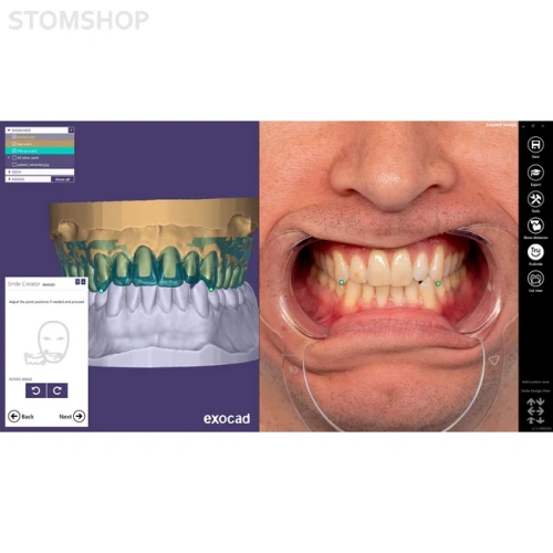 Exocad Smile Creator - модуль для планирования улыбки | Exocad (Германия)
