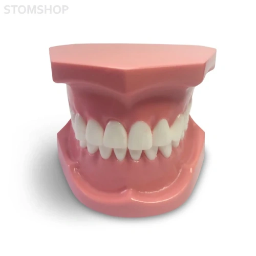 ORB01 – ортодонтическая модель с брекетами и твердой десной, 1 класс | GF Dental (Италия)