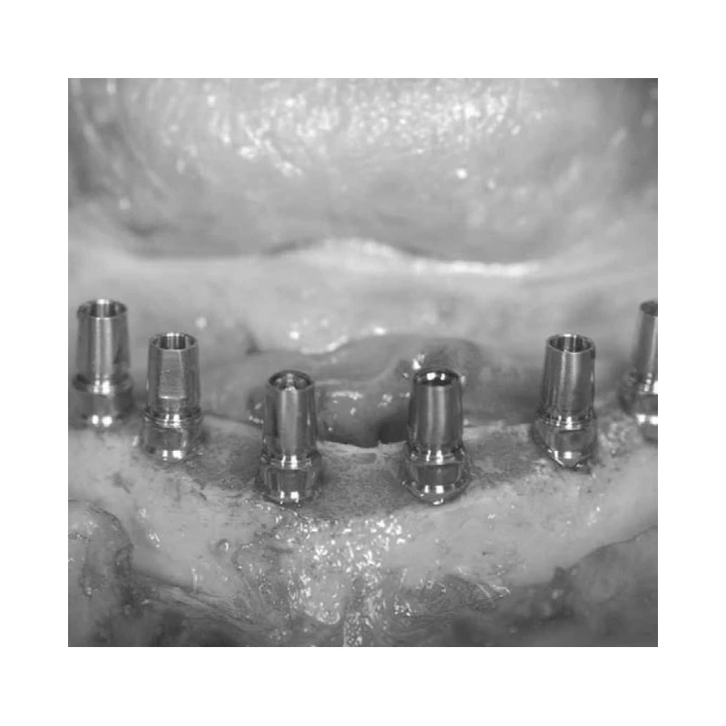 LM Implant Misura MR Kit - набор имплантологический | LM-Instruments Oy (Финляндия)