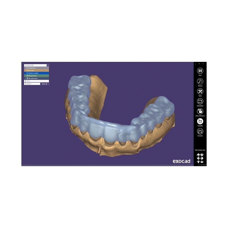 Exocad Bite Splint Module - модуль для создания терапевтических капп | Exocad (Германия)