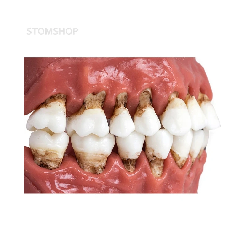 Модель верхней и нижней челюсти с различными патологиями | Dentalstore (Италия)