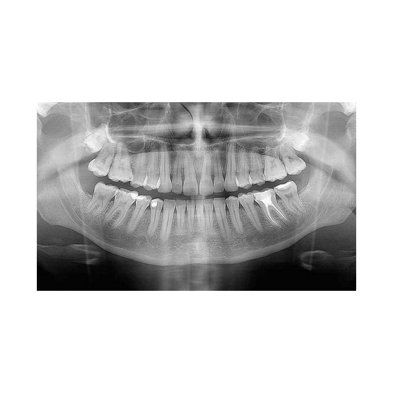 FONA Art Plus/Art Plus C - рентгенографическая цифровая система панорамной съемки | FONA Dental s.r.o. (Италия)