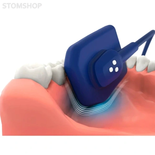EzSensor Soft 2.0 - цифровой радиовизиограф, размер 2.0 | Vatech (Ю. Корея)