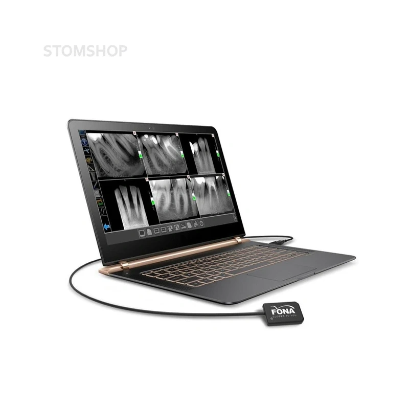 Комплект Xelium Ultra PD и Fona StarX PRO - низкочастотный портативный дентальный рентген с визиографом