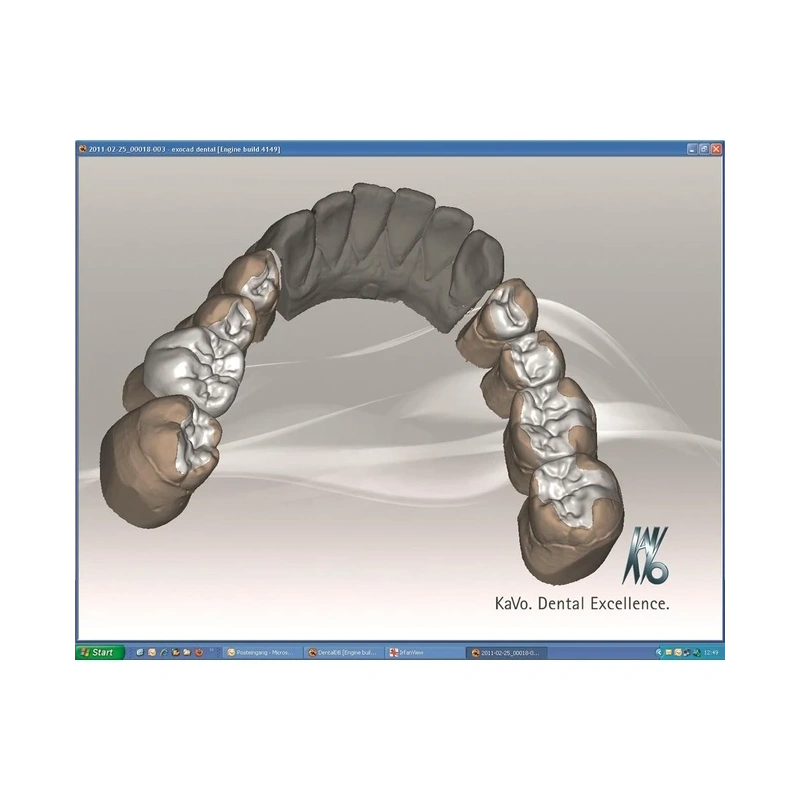 KaVo ARCTICA advanced - CAD/CAM система | KaVo (Германия)