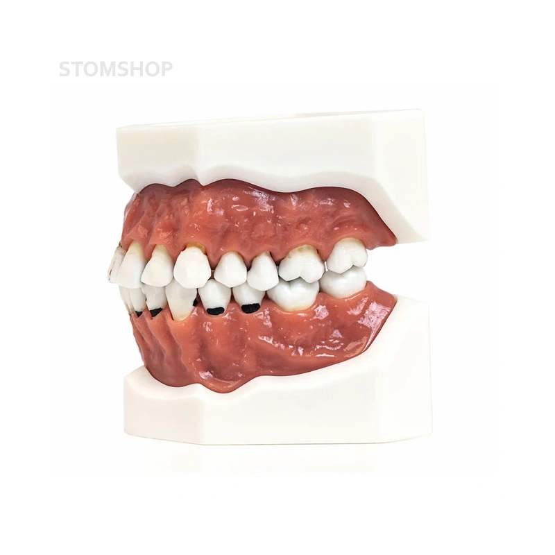 Модель верхней и нижней челюсти с различными патологиями | Dentalstore (Италия)