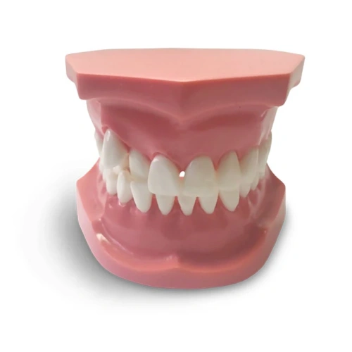 ORB05 – ортодонтическая модель с брекетами и твердой десной, 3 класс | GF Dental (Италия)
