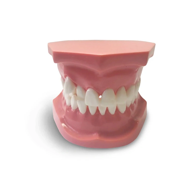 ORB05 – ортодонтическая модель с брекетами и твердой десной, 3 класс | GF Dental (Италия)