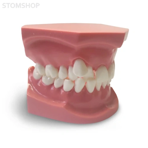 ORB05 – ортодонтическая модель с брекетами и твердой десной, 3 класс | GF Dental (Италия)