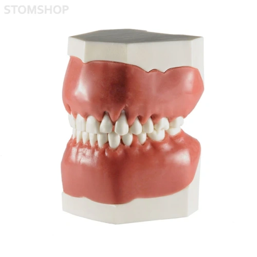 Модель верхней и нижней челюсти для отработки навыков закрытия рецессии | Dentalstore (Италия)