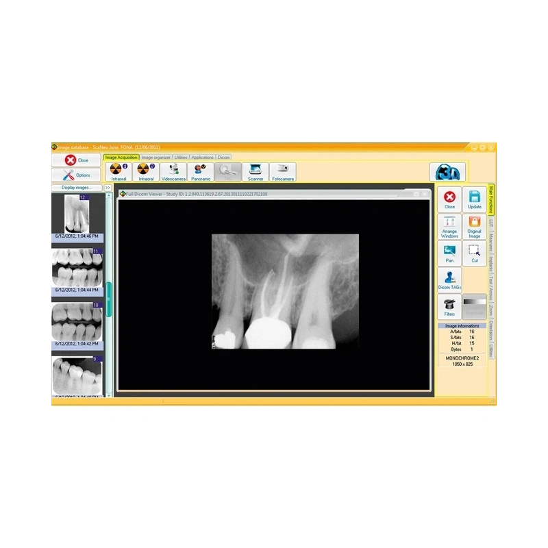 FONA CDR powered by SCHICK - система компьютерной стоматологической радиографии | FONA Dental s.r.o. (Италия)