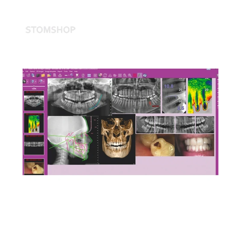 Hyperion X9 Pro 16х18 - дентальный цифровой 3D-томограф с цефалостатом, 3 в 1, FOV 16x18 | MyRay (Италия)