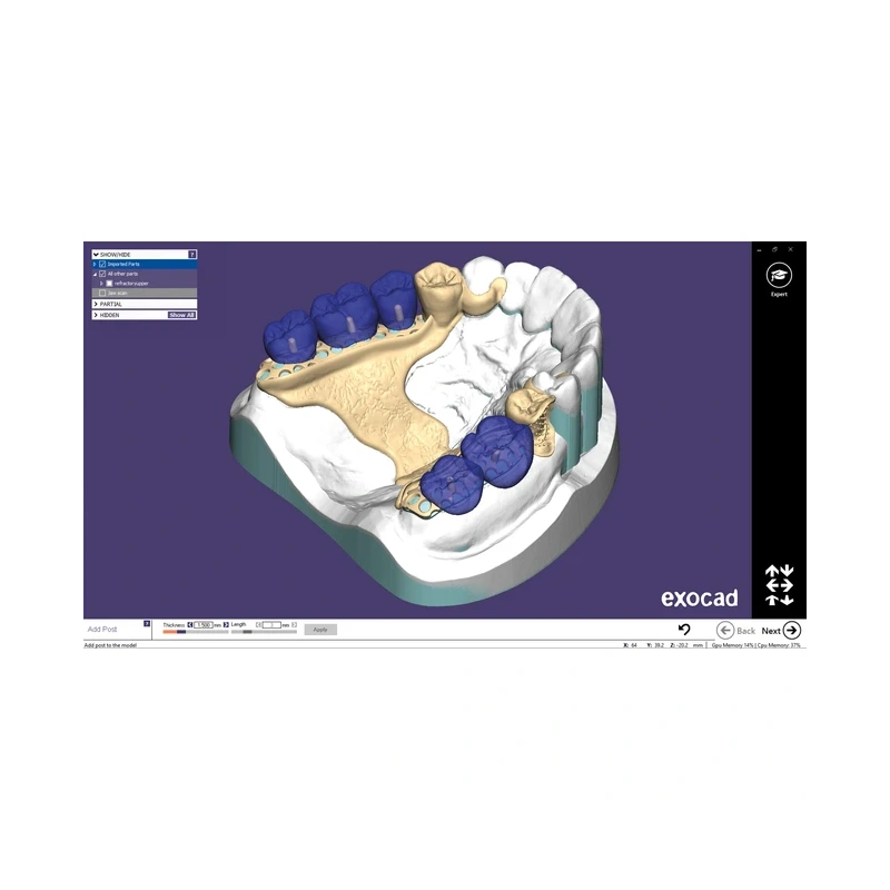 Exocad Partial Framework Module - модуль для создания бюгелей | Exocad (Германия)
