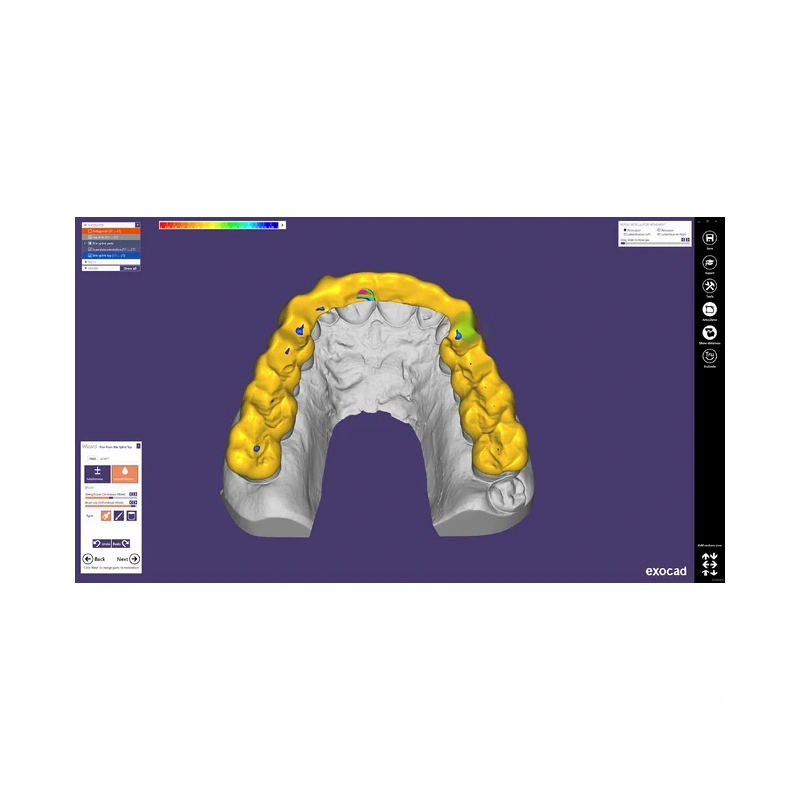 Exocad Bite Splint Module - модуль для создания терапевтических капп | Exocad (Германия)