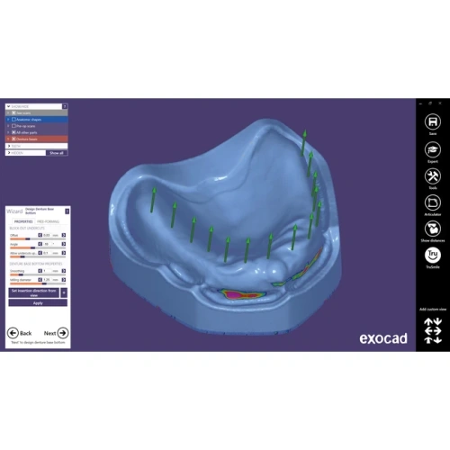 Exocad Full Denture Module - модуль для создания полносъемных протезов | Exocad (Германия)