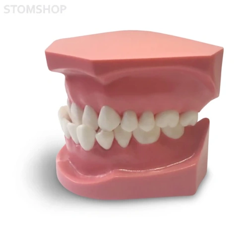 ORB04 – ортодонтическая модель с брекетами и твердой десной | GF Dental (Италия)