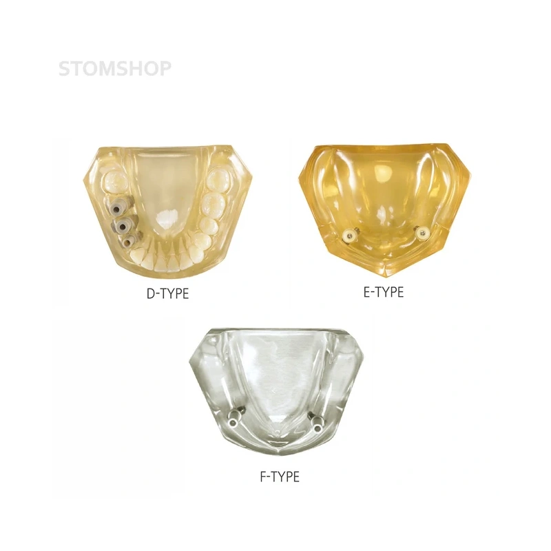 CRYSTAL IMPLANT MODEL - модель для демонстрации установки имплантатов | Hanil (Ю. Корея)