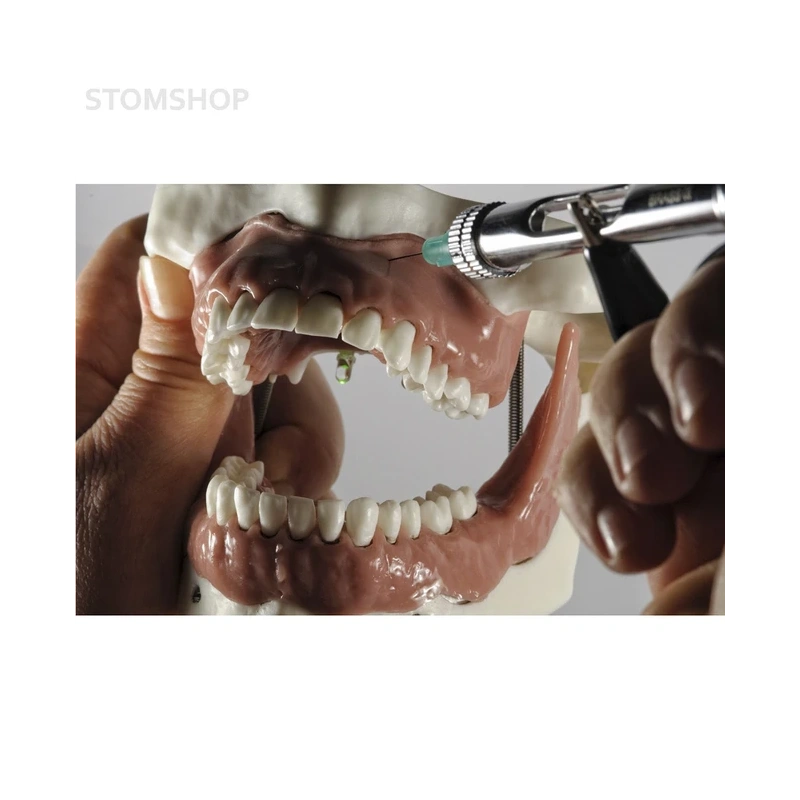 Модель челюсти для практики проведения местной анестезии | Dentalstore (Италия)